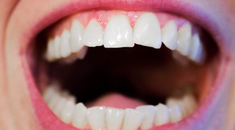 Distúrbios temporomandibulares - Distúrbios da boca e dos dentes